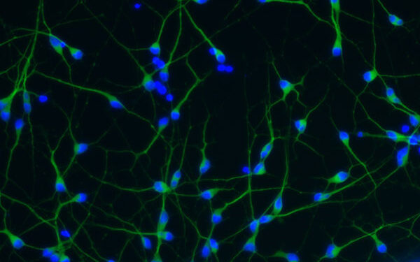 Diabeteksen kantasoluhoitoa tutkineille biolääketieteen Suomen mestaruus